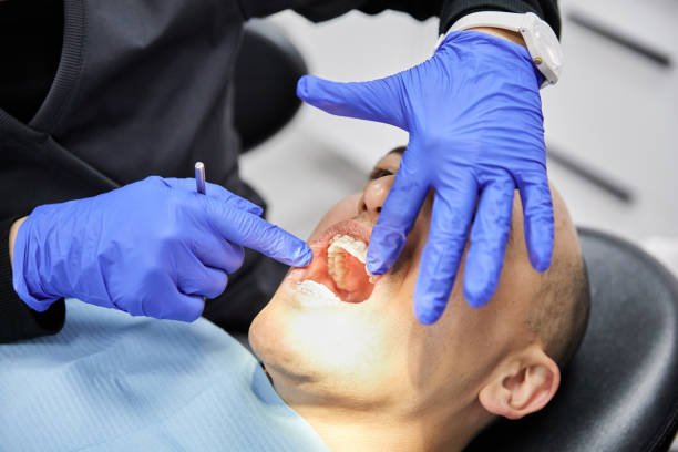 Best Emergency Tooth Extraction in Chesterfield, IN